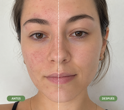 Mascarilla Para La Cara De Té Verde