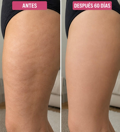 Crema Reductora de Estrías y Celulitis